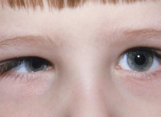 Μαγνητικά εμφυτεύματα για τη διαταραχή του νυσταγμού