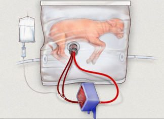 Δημιούργησαν θερμοκοιτίδα – μήτρα για τα πιο πρόωρα βρέφη