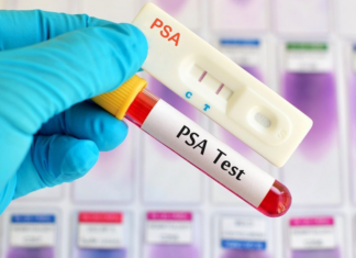 Νέα δραστική ουσία δίνει ελπίδες για τον καρκίνο του προστάτη