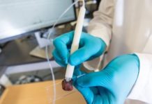 Xειρουργικό πενάκι διακρίνει με ακρίβεια τον υγιή από τον καρκινικό ιστό