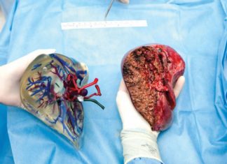 Προσομοίωση επεμβάσεων σε 3D μοντέλα ανθρώπινων οργάνων για πρώτη φορά στην Ελλάδα